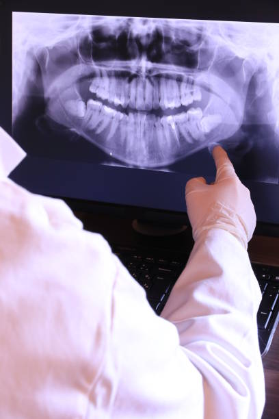 Best Knocked-Out Tooth (Avulsed Tooth) Treatment in Lake City, AR