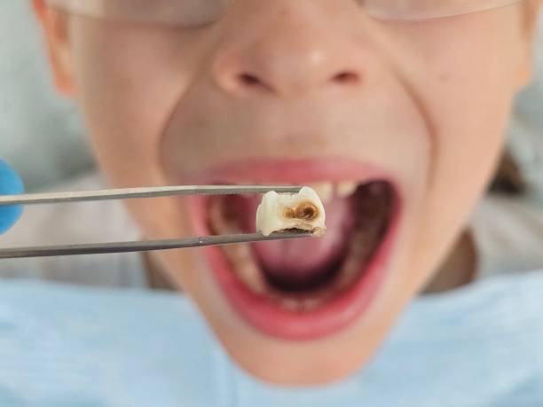 Best Emergency Pediatric Dental Care in Lake City, AR