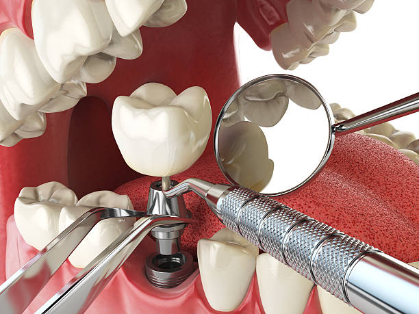 Best Dental Abscess Treatment in Lake City, AR
